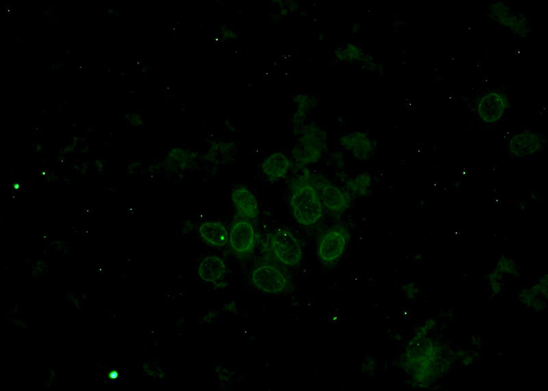 Immunofluorescent analysis of HepG2 cells using Catalog No:107347(IMP3 Antibody) at dilution of 1:50 and Alexa Fluor 488-congugated AffiniPure Goat Anti-Mouse IgG(H+L)