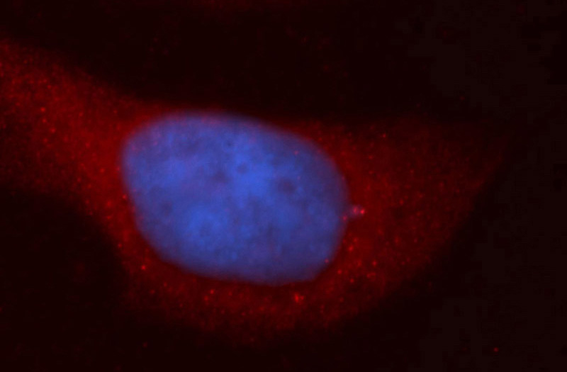 Immunofluorescent analysis of Hela cells, using URG4 antibody Catalog No:116643 at 1:50 dilution and Rhodamine-labeled goat anti-rabbit IgG (red). Blue pseudocolor = DAPI (fluorescent DNA dye).