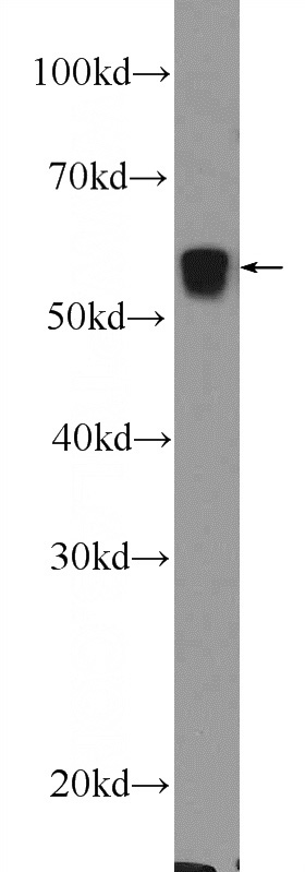 mouse heart tissue were subjected to SDS PAGE followed by western blot with Catalog No:113687(PCCB Antibody) at dilution of 1:600