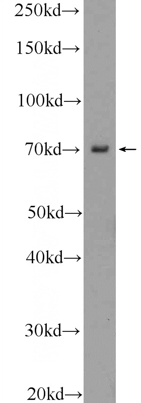 mouse eye tissue were subjected to SDS PAGE followed by western blot with Catalog No:116803(VSX1 Antibody) at dilution of 1:300