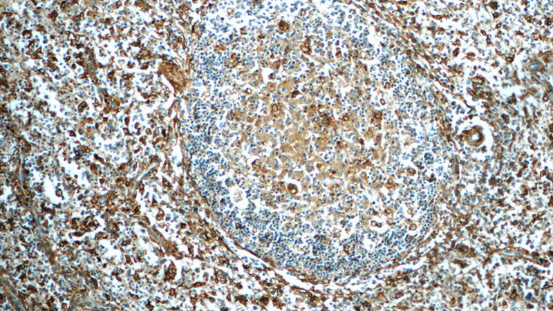 Immunohistochemistry of paraffin-embedded human spleen tissue slide using Catalog No:108096(ANXA5 Antibody) at dilution of 1:400 (under 10x lens)