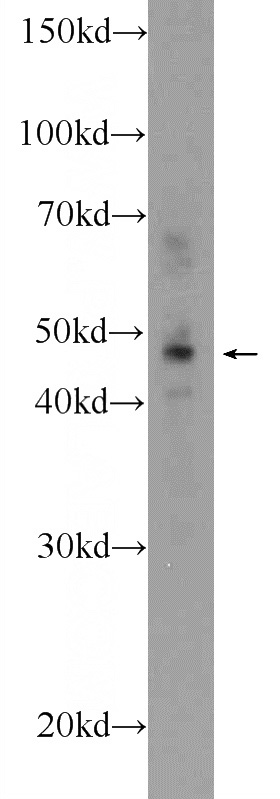 mouse brain tissue were subjected to SDS PAGE followed by western blot with Catalog No:111078(SLC2A3 Antibody) at dilution of 1:600
