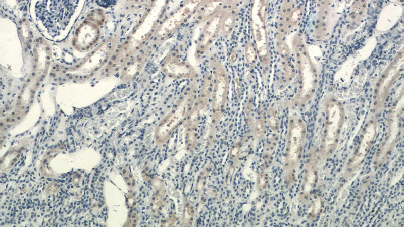 Immunohistochemical of paraffin-embedded human kidney using Catalog No:114945(RXRA antibody) at dilution of 1:200 (under 10x lens)