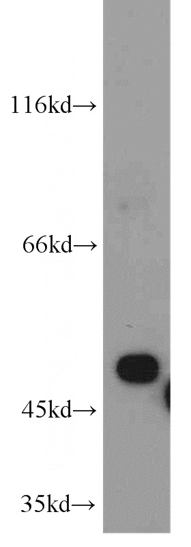 mouse liver tissue were subjected to SDS PAGE followed by western blot with Catalog No:110188(EIF2S2 antibody) at dilution of 1:1000