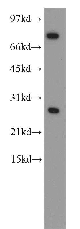 HeLa cells were subjected to SDS PAGE followed by western blot with Catalog No:108947(CBX5 antibody) at dilution of 1:500