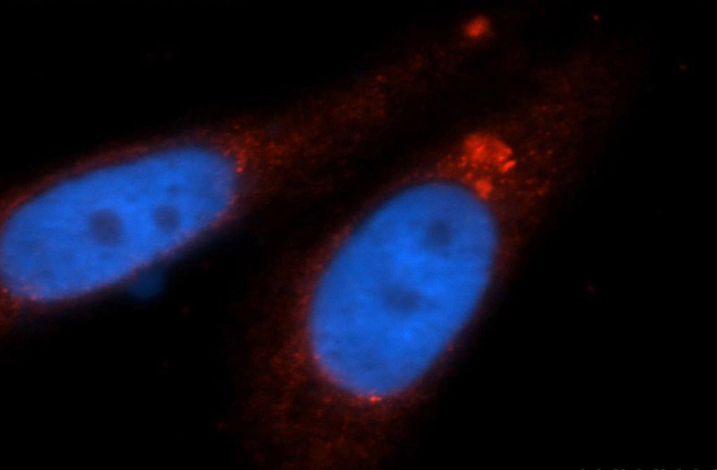 Immunofluorescent analysis of HepG2 cells, using RARB antibody Catalog No:114468 at 1:50 dilution and Rhodamine-labeled goat anti-rabbit IgG (red). Blue pseudocolor = DAPI (fluorescent DNA dye).