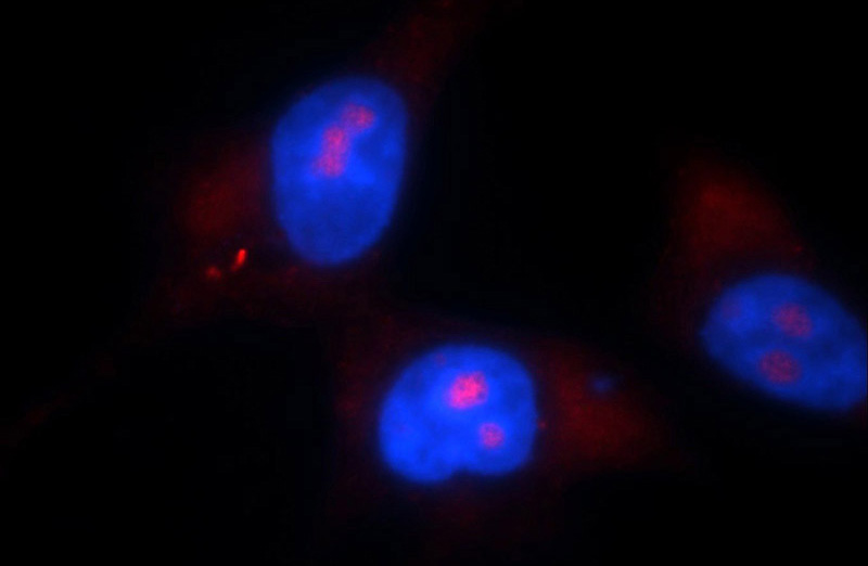 Immunofluorescent analysis of A431 cells using Catalog No:108826(CALML3 Antibody) at dilution of 1:50 and Rhodamine-Goat anti-Rabbit IgG