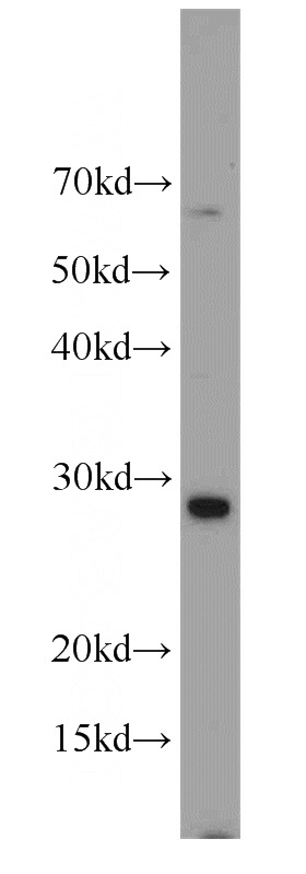 HepG2 cells were subjected to SDS PAGE followed by western blot with Catalog No:108797(C9orf11 antibody) at dilution of 1:2000