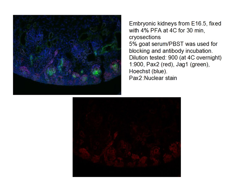 IF result of anti-PAX2(Catalog No:113604) with Embryonic kidney by Dr. Joo-Seop Park.