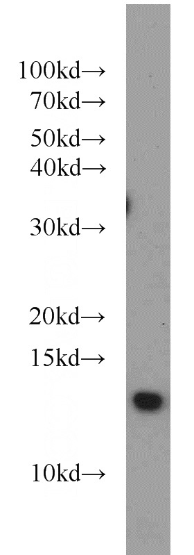 HEK-293 cells were subjected to SDS PAGE followed by western blot with Catalog No:109159(CDK2AP1 antibody) at dilution of 1:500