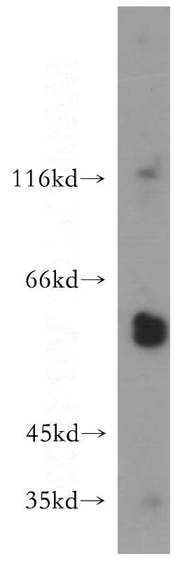 A549 cells were subjected to SDS PAGE followed by western blot with Catalog No:112703(MMP23B antibody) at dilution of 1:500