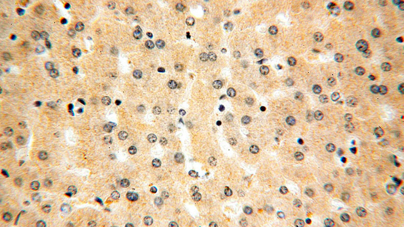 Immunohistochemical of paraffin-embedded human liver using Catalog No:107953(AARS antibody) at dilution of 1:100 (under 40x lens)