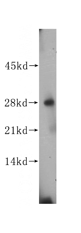 human colon tissue were subjected to SDS PAGE followed by western blot with Catalog No:107997(AMN1 antibody) at dilution of 1:400