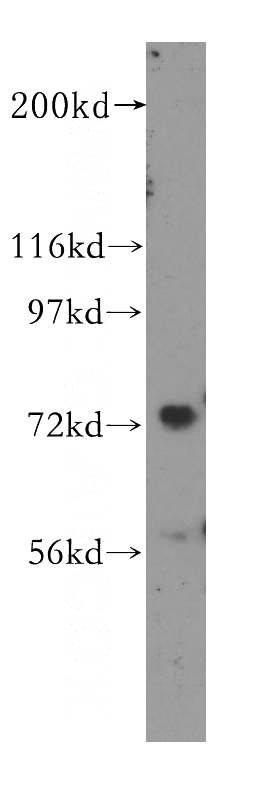 K-562 cells were subjected to SDS PAGE followed by western blot with Catalog No:112657(MEPCE antibody) at dilution of 1:400