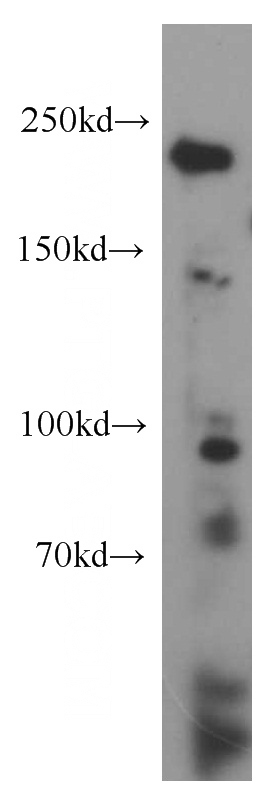K-562 cells were subjected to SDS PAGE followed by western blot with Catalog No:109939(DICER1 antibody) at dilution of 1:200