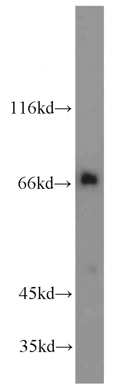 Jurkat cells were subjected to SDS PAGE followed by western blot with Catalog No:116904(ZAP70 antibody) at dilution of 1:1000
