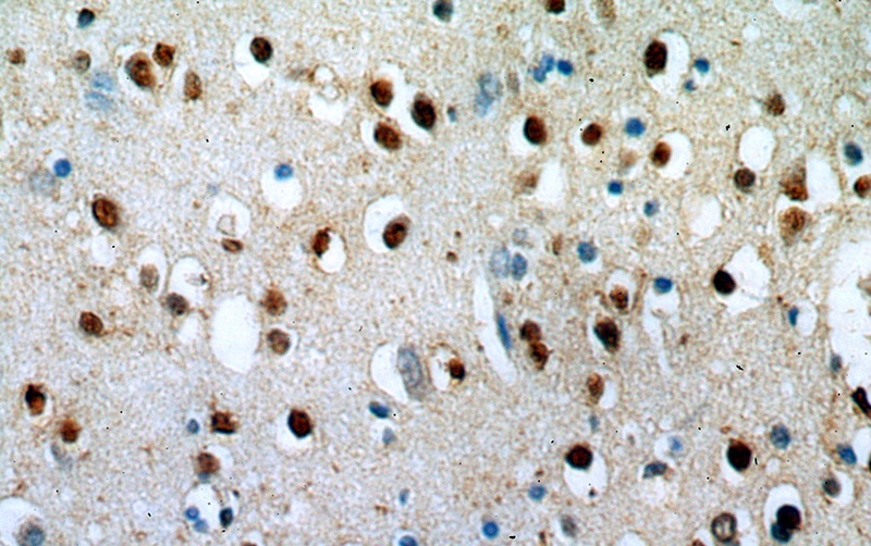 Immunohistochemical of paraffin-embedded human brain using Catalog No:117163(ZNF34 antibody) at dilution of 1:50 (under 40x lens)