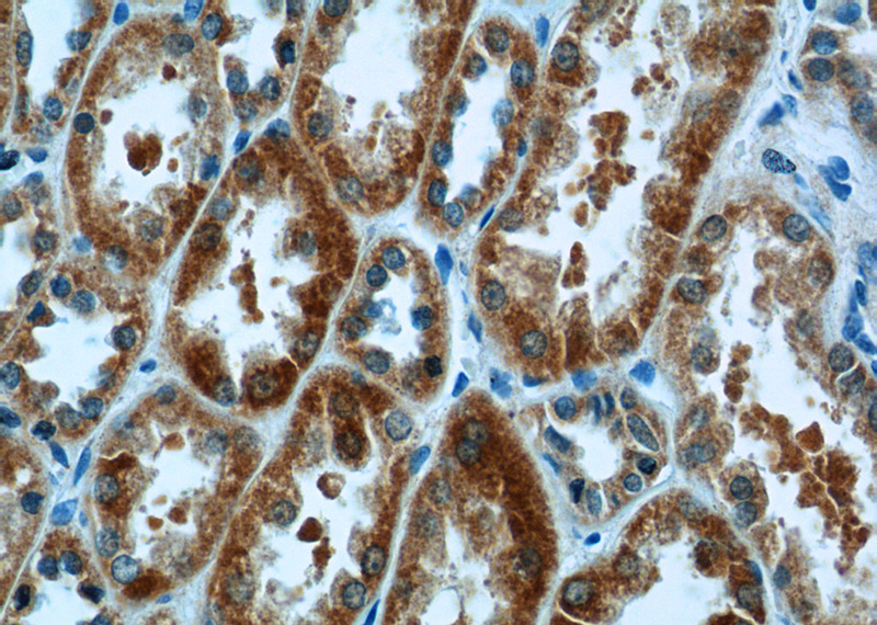Immunohistochemistry of paraffin-embedded human kidney tissue slide using Catalog No:108751(CA7 Antibody) at dilution of 1:50 (under 40x lens)