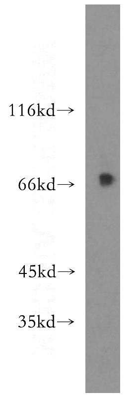 mouse testis tissue were subjected to SDS PAGE followed by western blot with Catalog No:116597(USP2 antibody) at dilution of 1:500