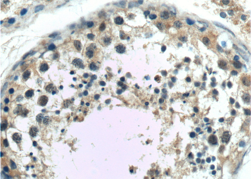 Immunohistochemistry of paraffin-embedded human testis tissue slide using Catalog No:108645(C11orf79 Antibody) at dilution of 1:50 (under 40x lens)