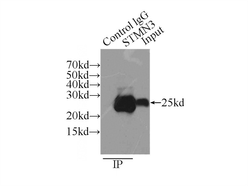 IP Result of anti-STMN3 (IP:Catalog No:115727, 3ug; Detection:Catalog No:115727 1:2000) with mouse brain tissue lysate 8000ug.
