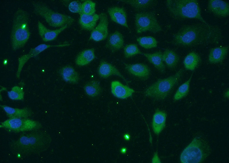 Immunofluorescent analysis of A431 cells using Catalog No:115968(TACC2 Antibody) at dilution of 1:25 and Alexa Fluor 488-congugated AffiniPure Goat Anti-Rabbit IgG(H+L)