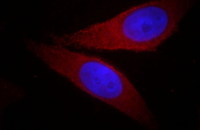 Immunofluorescent analysis of MCF-7 cells, using AKT1 antibody Catalog No: at 1:50 dilution and Rhodamine-labeled goat anti-mouse IgG (red). Blue pseudocolor = DAPI (fluorescent DNA dye).