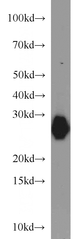 mouse heart tissue were subjected to SDS PAGE followed by western blot with Catalog No:112943(MYL3 antibody) at dilution of 1:1000