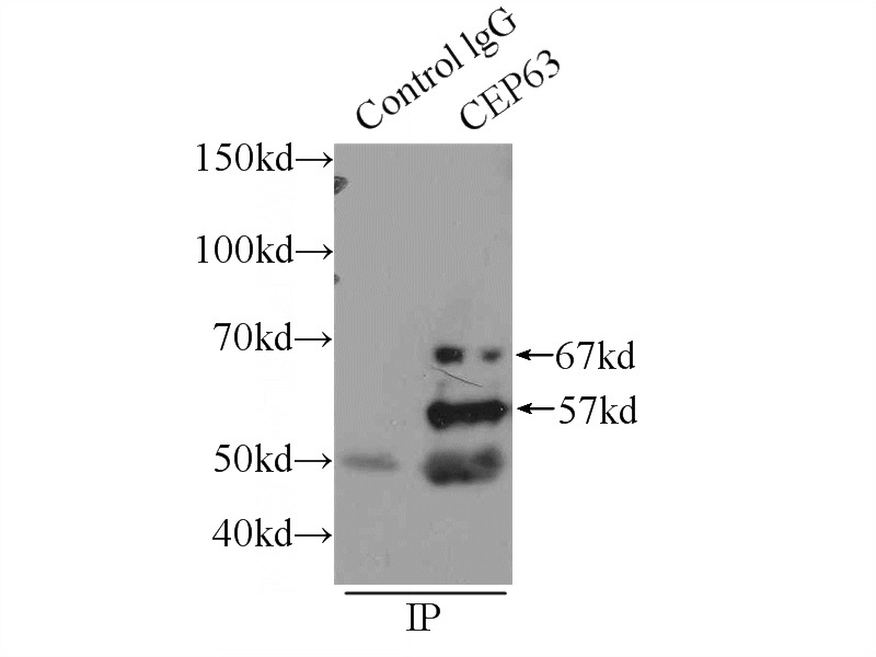 IP Result of anti-CEP63 (IP:Catalog No:109183, 3ug; Detection:Catalog No:109183 1:500) with HEK-293 cells lysate 1700ug.