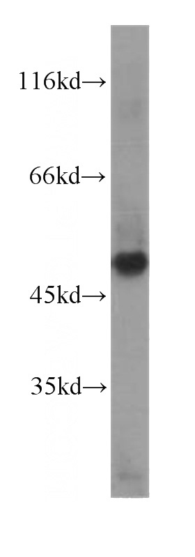 human testis tissue were subjected to SDS PAGE followed by western blot with Catalog No:107506(Scpep1 antibody) at dilution of 1:1000