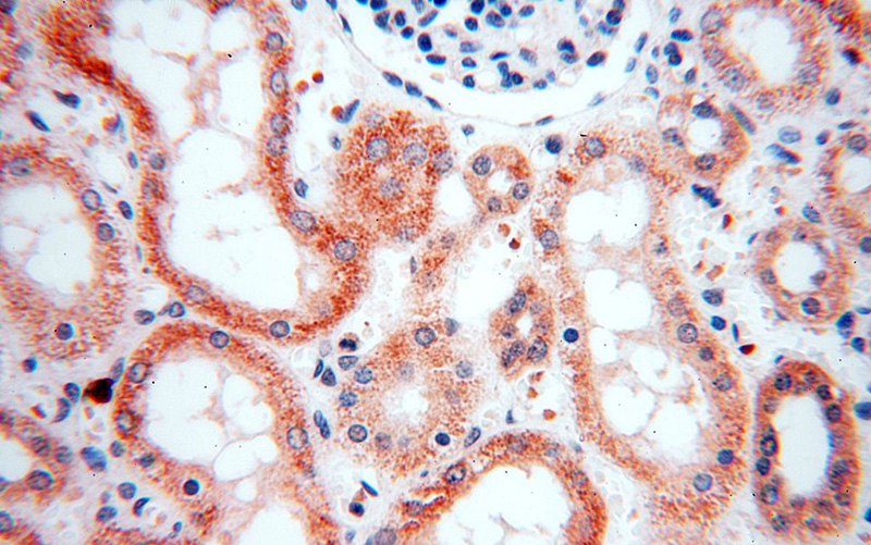 Immunohistochemical of paraffin-embedded human kidney using Catalog No:115063(SAPS3 antibody) at dilution of 1:100 (under 40x lens)