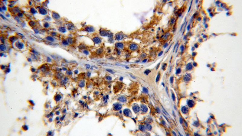Immunohistochemical of paraffin-embedded human testis using Catalog No:114237(PRPS1 antibody) at dilution of 1:50 (under 40x lens)