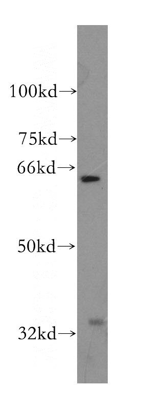 PC-3 cells were subjected to SDS PAGE followed by western blot with Catalog No:113501(PAK6 antibody) at dilution of 1:400