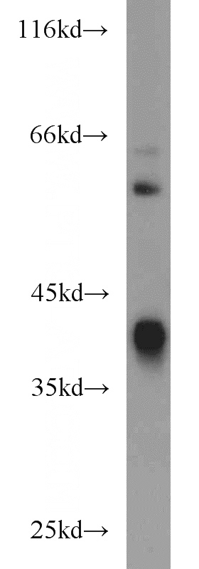 mouse liver tissue were subjected to SDS PAGE followed by western blot with Catalog No:107788(ADH4 antibody) at dilution of 1:200