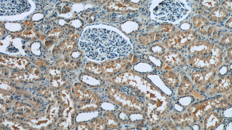 Immunohistochemistry of paraffin-embedded human kidney tissue slide using Catalog No:112440(MAPKAPK2 Antibody) at dilution of 1:50 (under 10x lens)