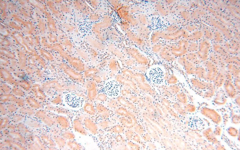 Immunohistochemical of paraffin-embedded human kidney using Catalog No:108303(ATP6V0D1 antibody) at dilution of 1:100 (under 10x lens)