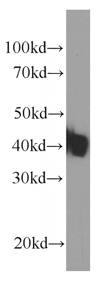 human skeletal muscle tissue were subjected to SDS PAGE followed by western blot with Catalog No:107364(KLF15 Antibody) at dilution of 1:2000