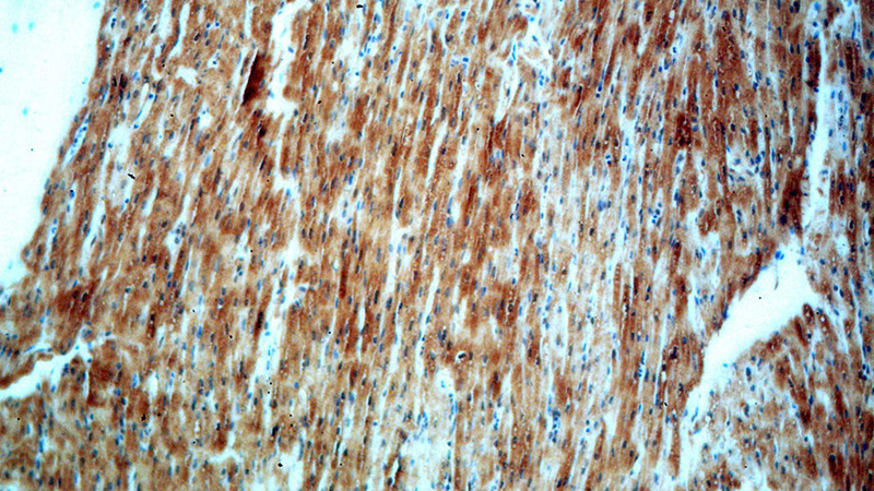 Immunohistochemical of paraffin-embedded human heart using Catalog No:111908(KANK1 antibody) at dilution of 1:50 (under 10x lens)