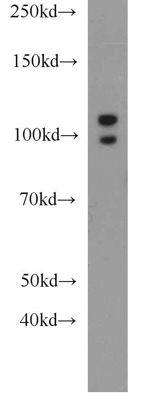 mouse kidney tissue were subjected to SDS PAGE followed by western blot with Catalog No:107965(ALDH1L2 antibody) at dilution of 1:1000