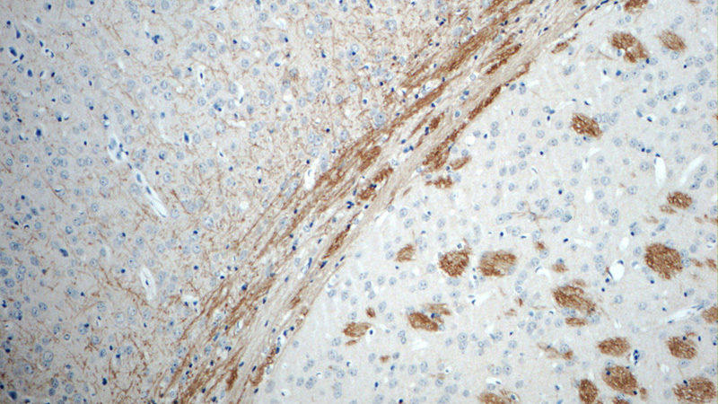 Immunohistochemistry of paraffin-embedded mouse brain tissue slide using Catalog No:110351(EPHA6-Specific Antibody) at dilution of 1:50 (under 10x lens)