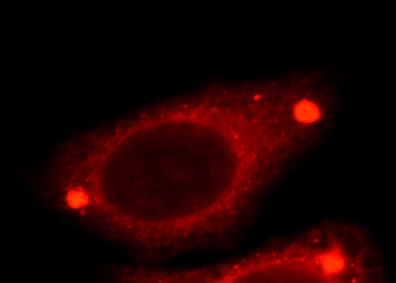 Immunofluorescent analysis of HepG2 cells, using TMED9 antibody Catalog No:116088 at 1:25 dilution and Rhodamine-labeled goat anti-rabbit IgG (red).