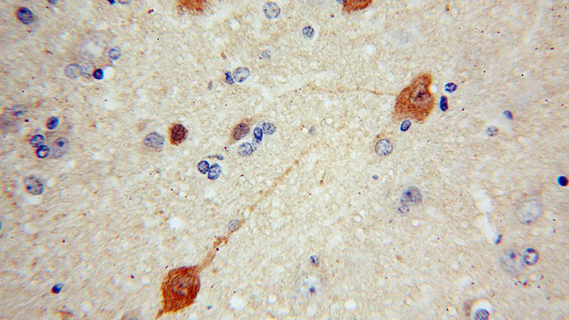 Immunohistochemical of paraffin-embedded human brain using Catalog No:114735(RNF10 antibody) at dilution of 1:100 (under 40x lens)