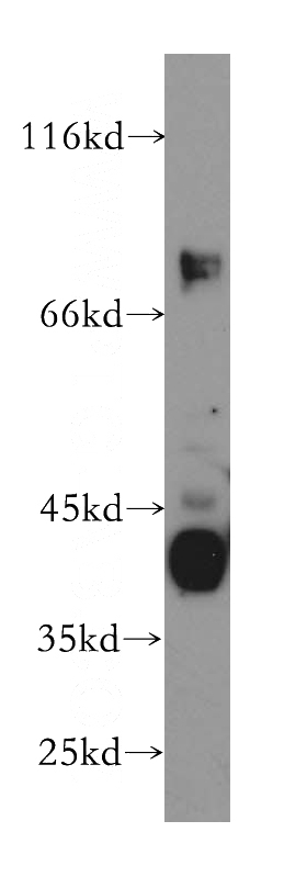 mouse brain tissue were subjected to SDS PAGE followed by western blot with Catalog No:116596(USP2 antibody) at dilution of 1:500