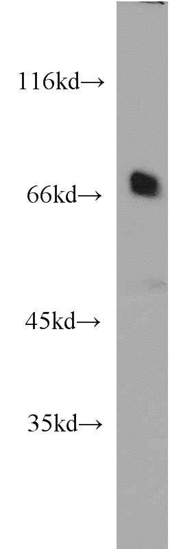 HL-60 cells were subjected to SDS PAGE followed by western blot with Catalog No:115473(SNX18 antibody) at dilution of 1:1000