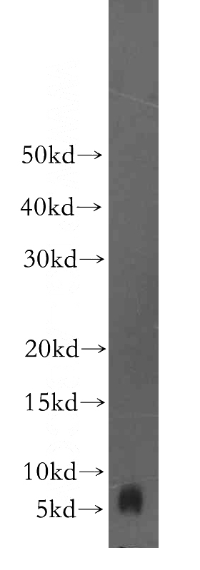 HEK-293 cells were subjected to SDS PAGE followed by western blot with Catalog No:110754(FXYD2 antibody) at dilution of 1:1000