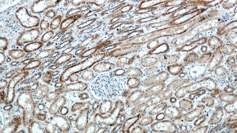 Immunohistochemistry of paraffin-embedded human kidney slide using Catalog No:108106(SLC25A5 Antibody) at dilution of 1:50