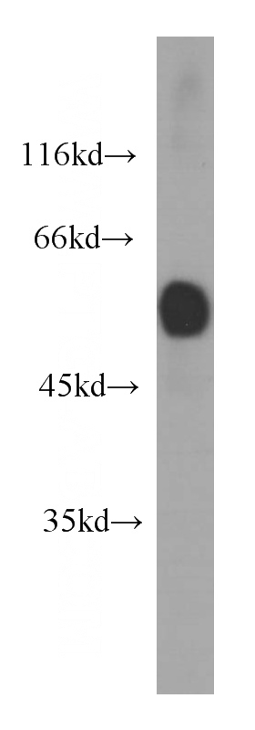 human heart tissue were subjected to SDS PAGE followed by western blot with Catalog No:107239(DES antibody) at dilution of 1:1000