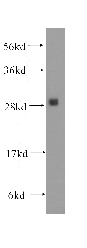 human brain tissue were subjected to SDS PAGE followed by western blot with Catalog No:114025(PMM1 antibody) at dilution of 1:500