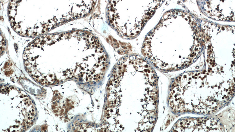 Immunohistochemistry of paraffin-embedded human testis tissue slide using Catalog No:112387(MAGEC2 Antibody) at dilution of 1:50 (under 10x lens)