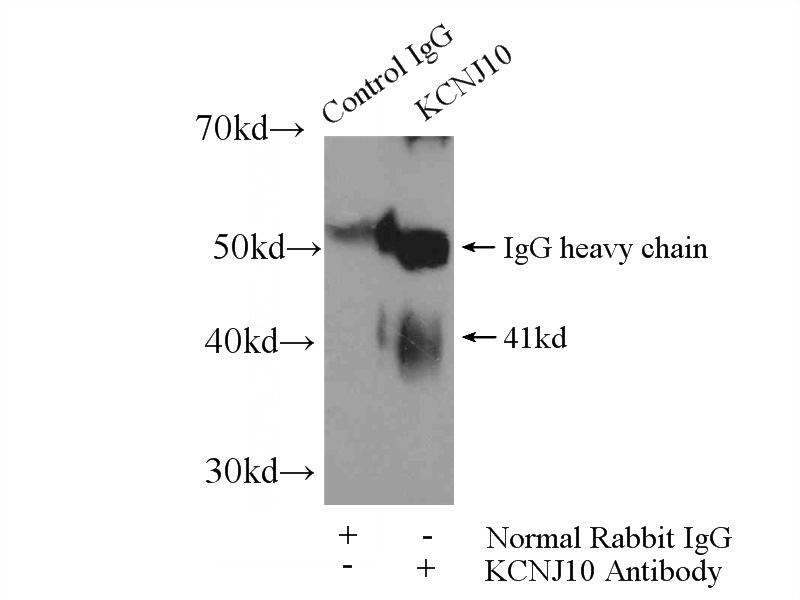 IP Result of anti-KCNJ10 (IP:Catalog No:112064, 4ug; Detection:Catalog No:112064 1:500) with rat brain tissue lysate 4800ug.